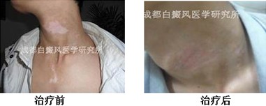 �������ư��粡�����