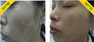 �ɶ����粡������Щ