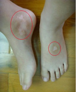 �Ų������������