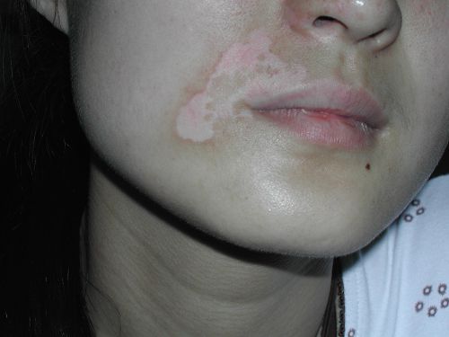 �����ճ�������Ӧ��ע��ʲô