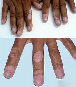 ���縴��ʱ��֢״������Щ��