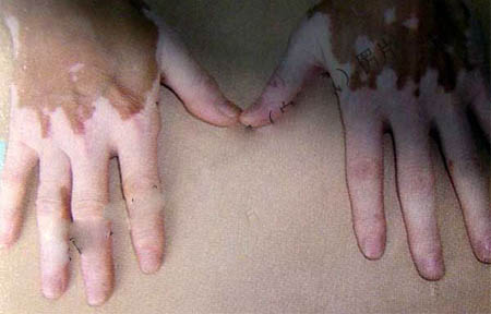 ��ο���������ɢ�еİ���