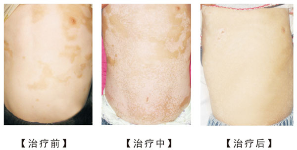 ����Ϊʲô�ᷴ������