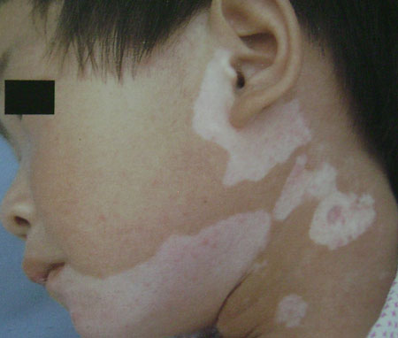 ��������Щ֢״����