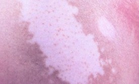 �ճ������а��综��Ҫע��ʲô