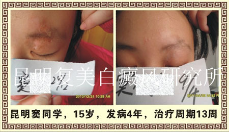 Ů�Բ���������η���