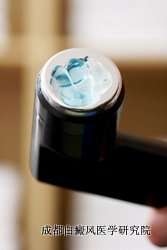 白癜风后期有什么症状