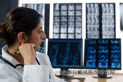 引发白癜风发作的原因是什么