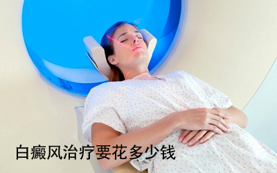 白癜风的治疗费用要多少