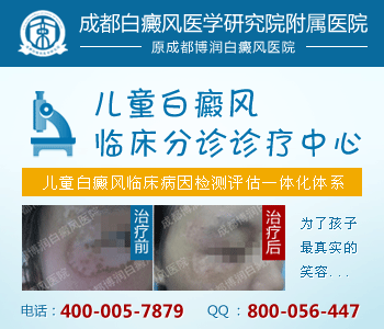 白癜风要如何预防好 白癜风要如何预防好