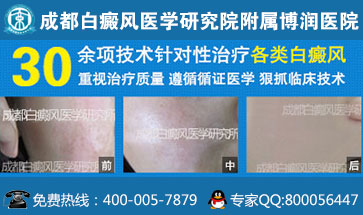 白癜风的致病因素有哪些