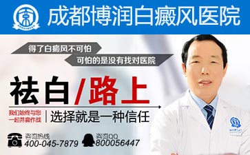 白癜风什么症状