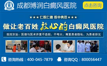 白癜风前期症状是什么