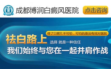 白癜风激光治疗