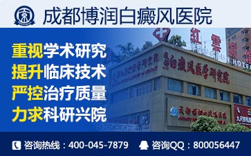 头部白癜风个的症状中药