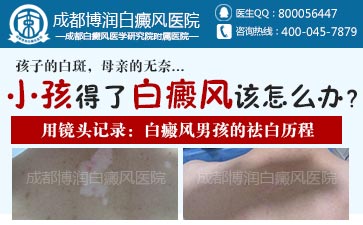 白癜风较早的症状