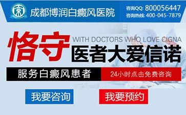 儿童白癜风的症状有哪些