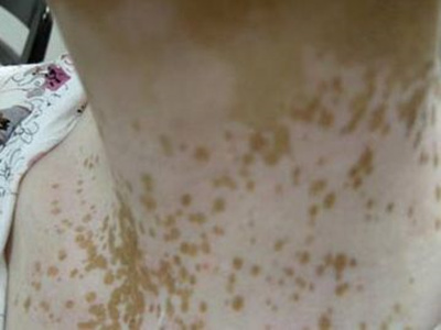 成都治疗白殿童学娅特约